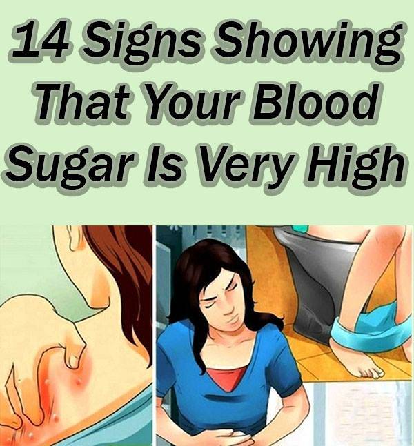 14 Signs Showing That Your Blood Sugar Is Very High â Info You Should Know