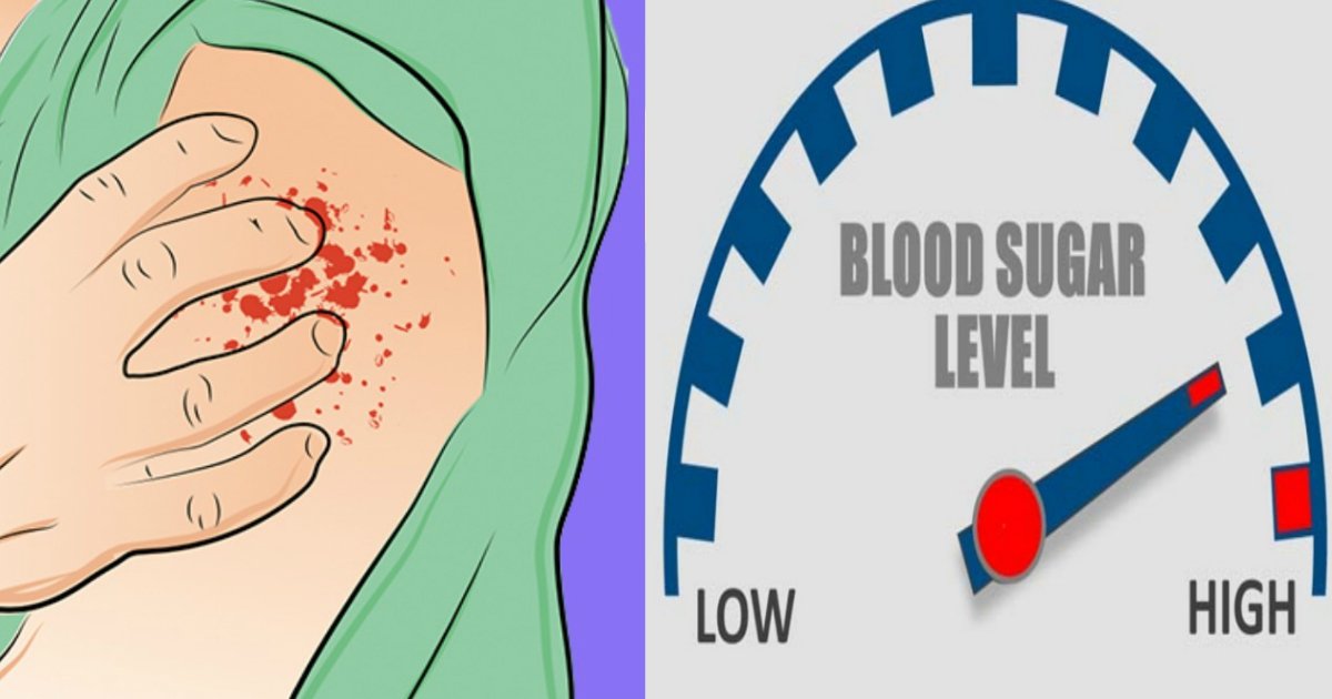 16 Symptoms That Indicate Your Blood Sugar Level Is Too High