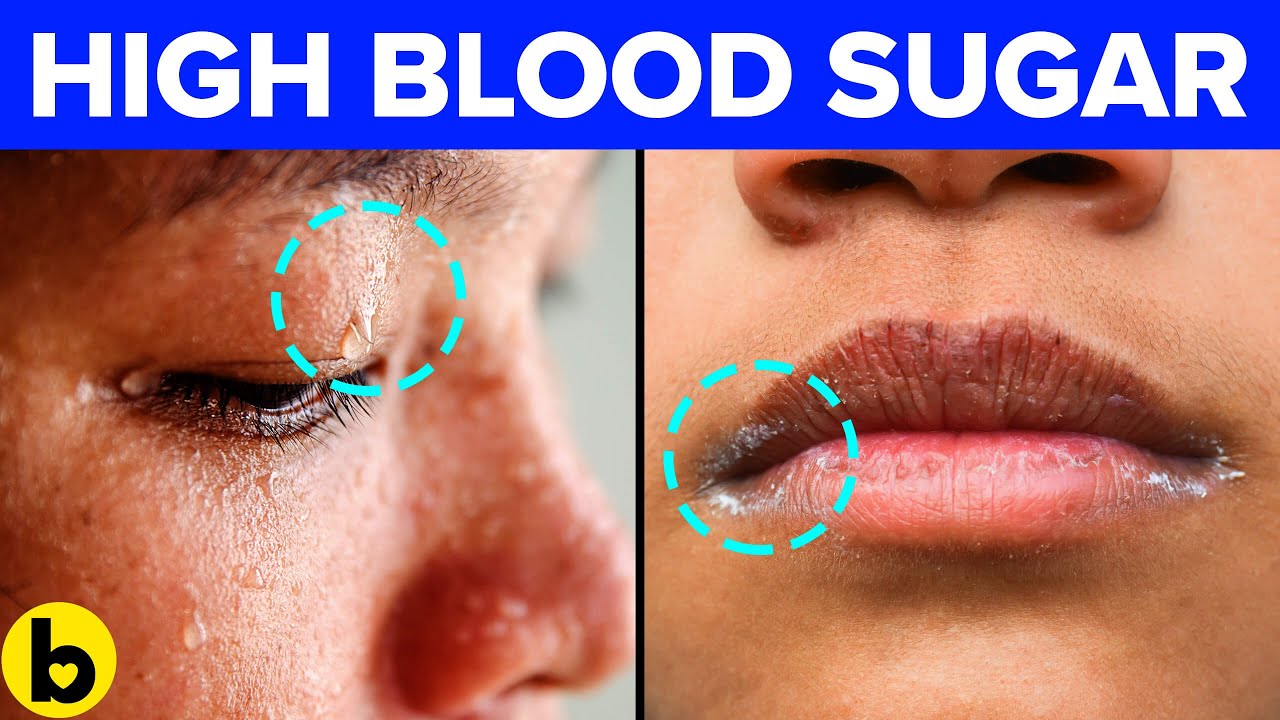 9 Signs Your Blood Sugar Is Too High