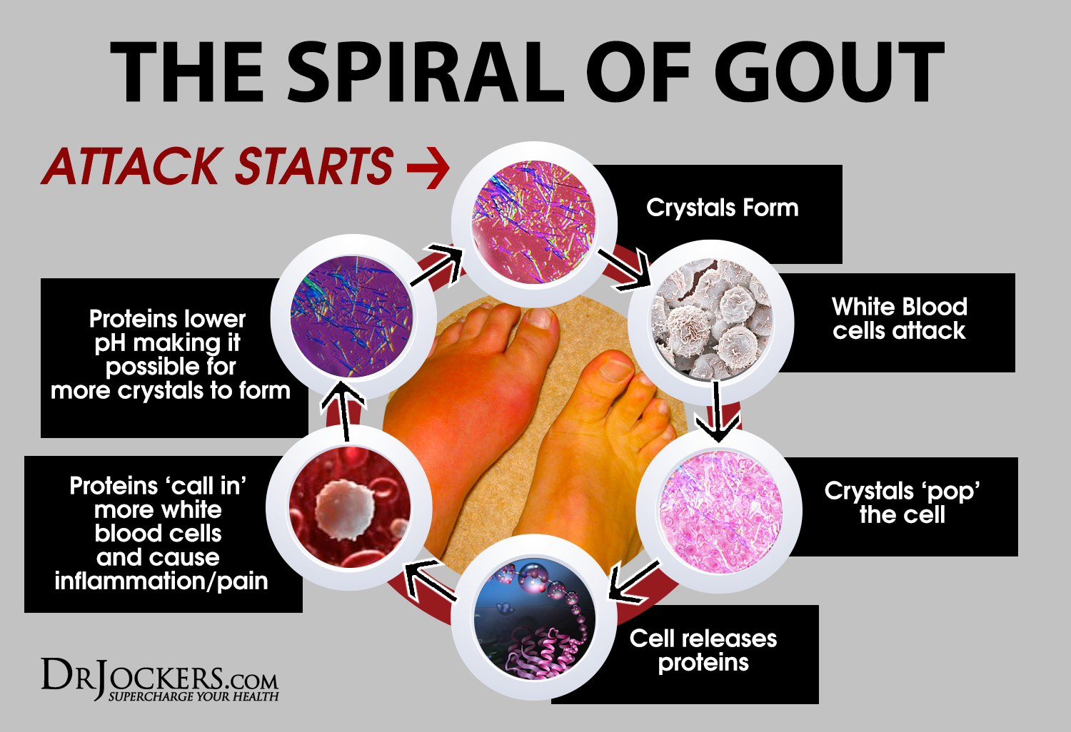 Beat Gout Naturally