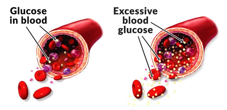 Blood sugar levels and Paleo