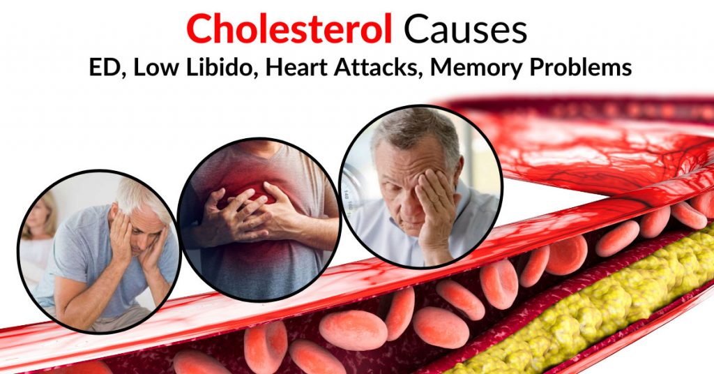 Cholesterol Causes ED, Low Libido, Heart Attacks, Memory Problems, Etc ...