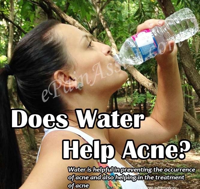 designbymdg: Does Drinking Water Prevent Acne