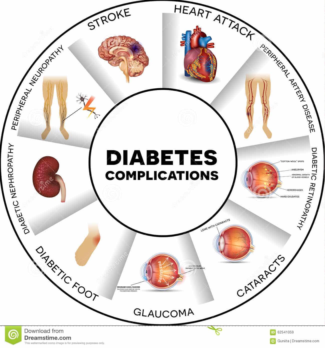 » Diabetes And Misdirection: What The Doctors Are Not Telling You  KTIE 5