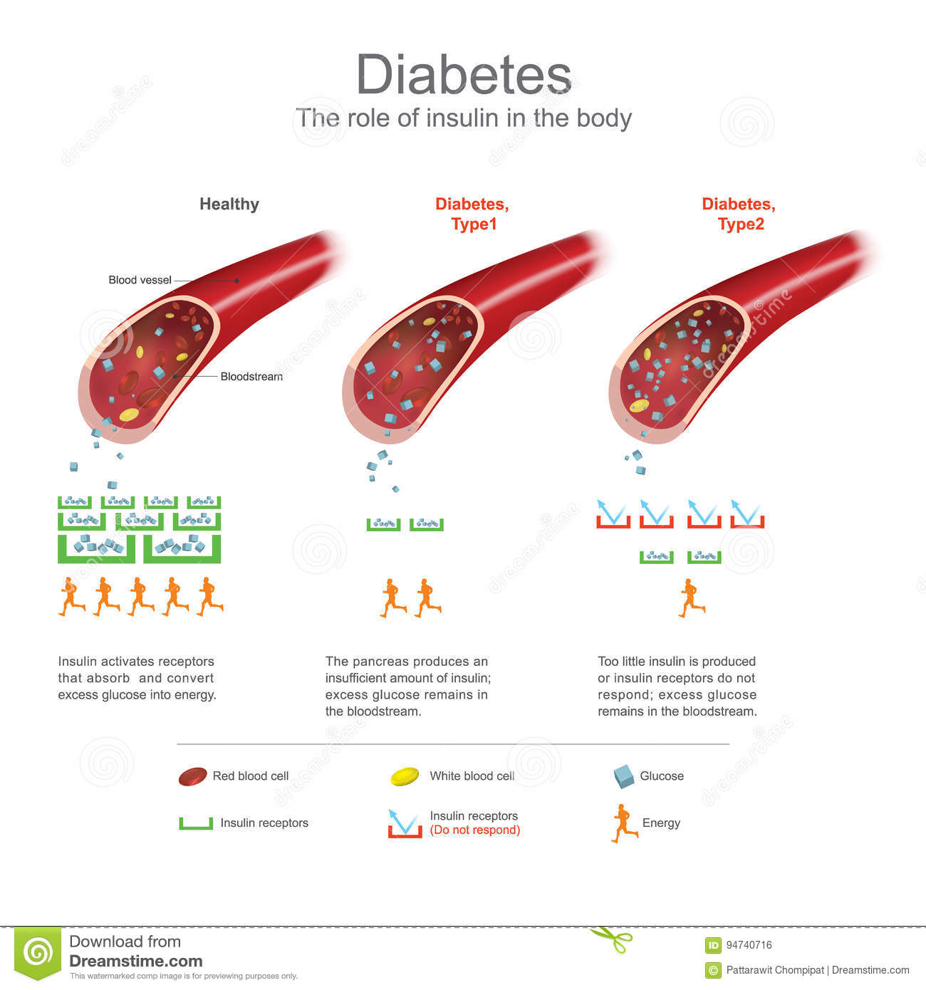 Diabetes. Health Care Info Graphic. Vector Design. Stock ...