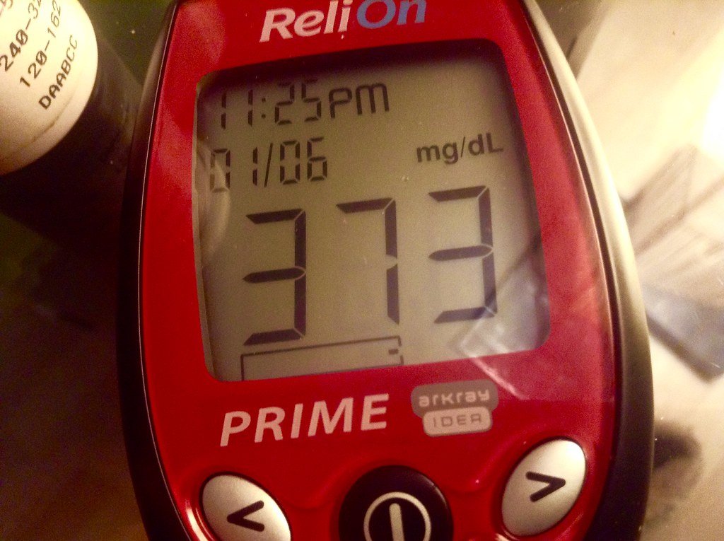 High Blood Sugar Over 300mg Test Readings Glucose Level, 1