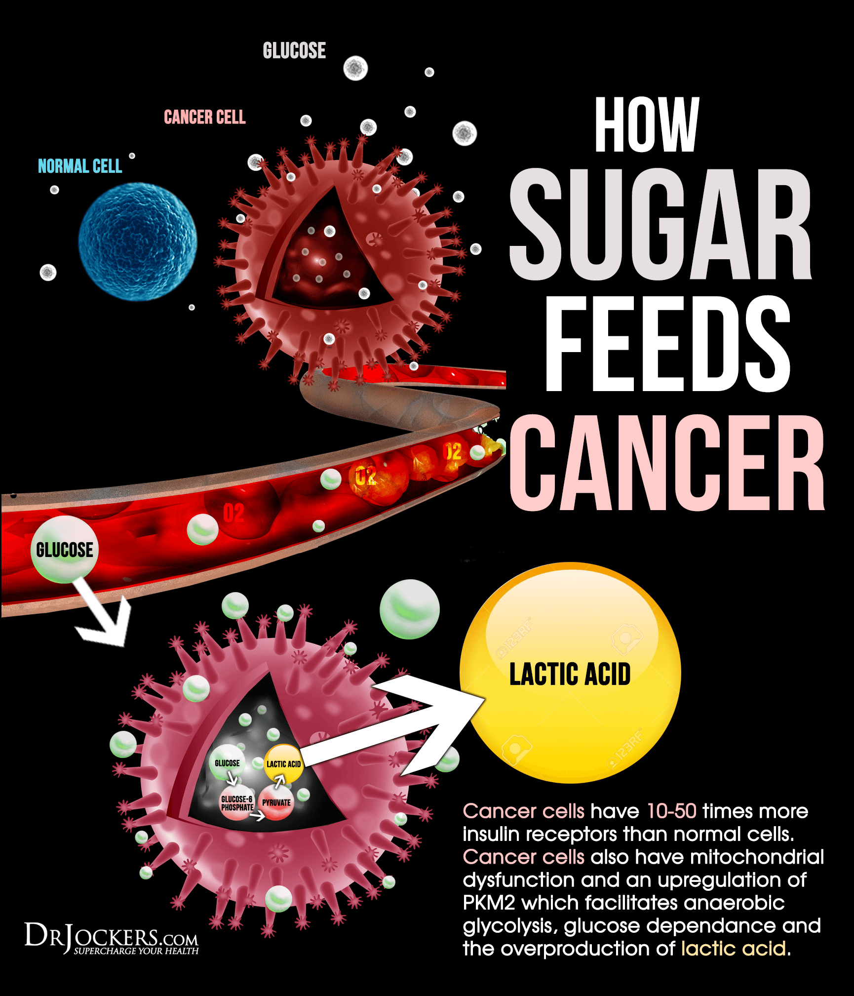 How Sugar Feeds Cancer Growth