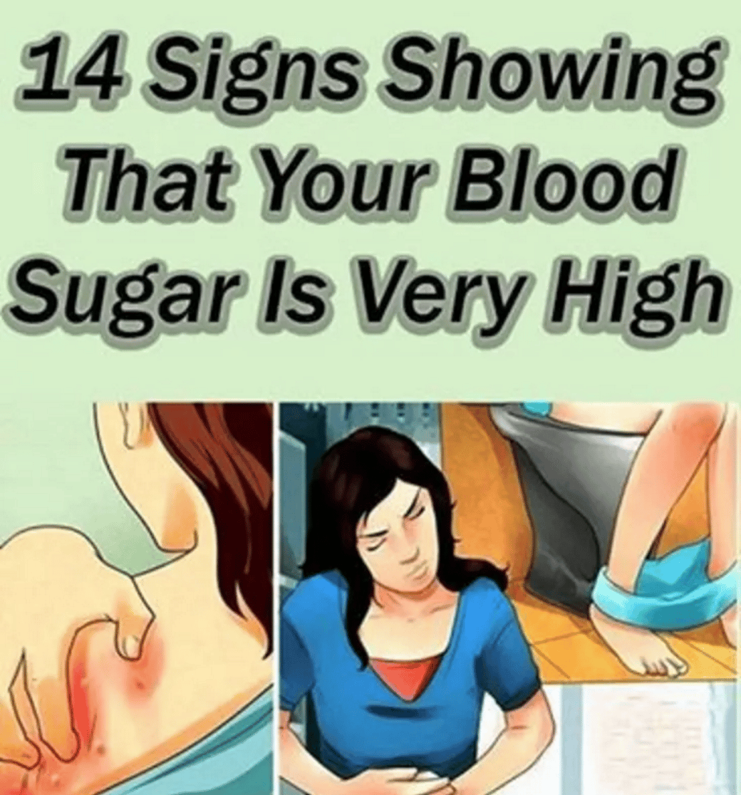 Symptoms Of Blood Sugar Too High