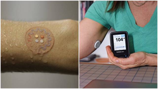 This sticky patch will test your blood sugar levels without finger ...